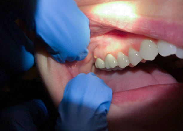Best Pediatric Emergency Dentist in Ack, NY