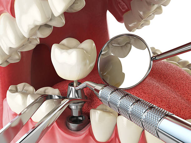 Best Emergency Treatment for Toothache in Ack, NY